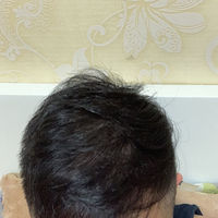 發(fā)際線用戶圖片