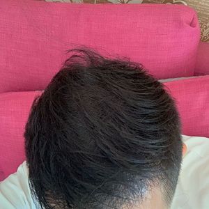 发际线分享社区