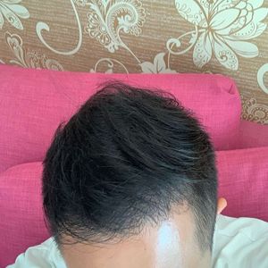 发际线分享社区