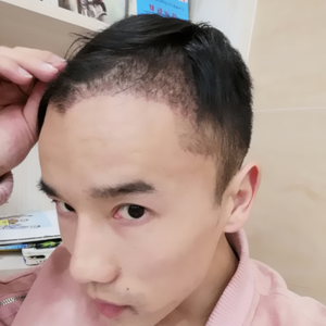 发际线分享社区