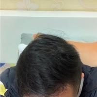 發(fā)際線用戶圖片