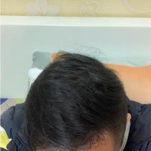 发际线分享社区