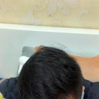 發(fā)際線用戶圖片