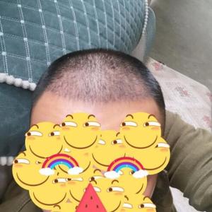 发际线分享社区