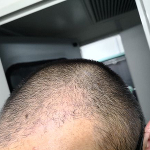 发际线分享社区