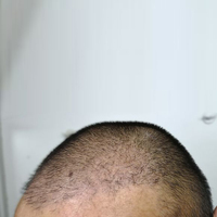 發(fā)際線用戶圖片
