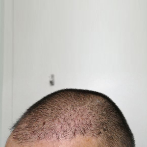 发际线分享社区