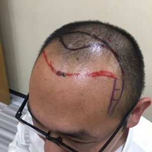 发际线分享社区