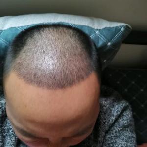 发际线分享社区