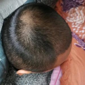 发际线分享社区