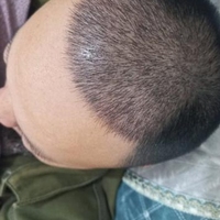 發(fā)際線用戶圖片