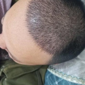 发际线分享社区