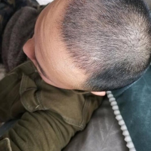 发际线分享社区