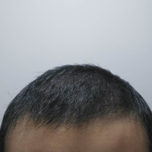 发际线分享社区