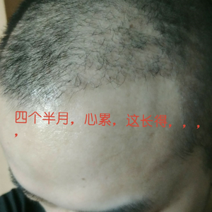 发际线分享社区