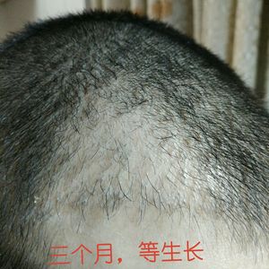 发际线分享社区