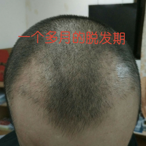发际线分享社区