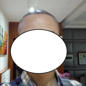 发际线分享社区