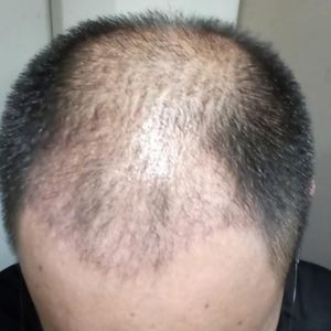 发际线分享社区