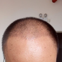 發(fā)際線用戶圖片