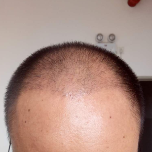 发际线分享社区