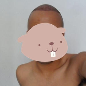 发际线分享社区