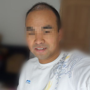 发际线分享社区