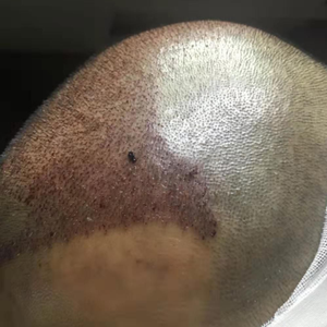 发际线分享社区