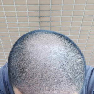 发际线分享社区