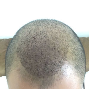 发际线分享社区