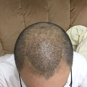 发际线分享社区