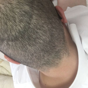 发际线分享社区