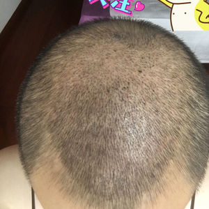 发际线分享社区