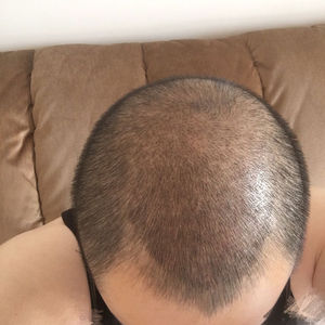发际线分享社区