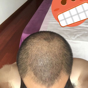 发际线分享社区