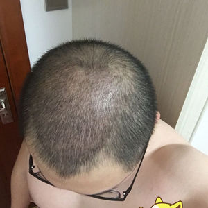 发际线分享社区