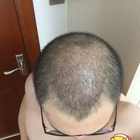 發(fā)際線用戶圖片