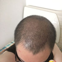 發(fā)際線用戶圖片