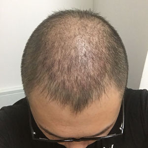 发际线分享社区