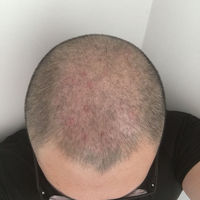 發(fā)際線用戶圖片