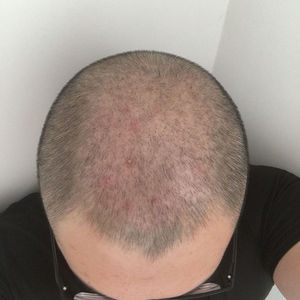 发际线分享社区