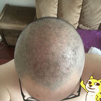 發(fā)際線用戶圖片