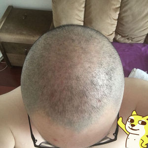 发际线分享社区