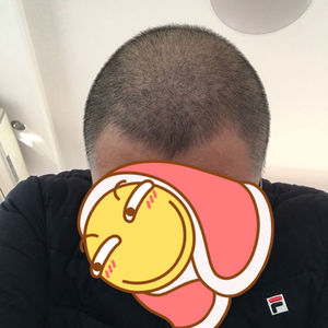 发际线分享社区