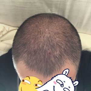 发际线分享社区