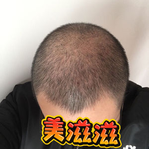 发际线分享社区