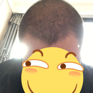 发际线分享社区