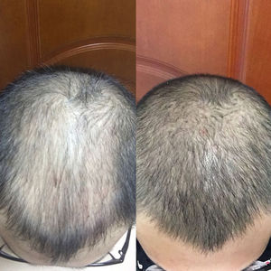 发际线分享社区