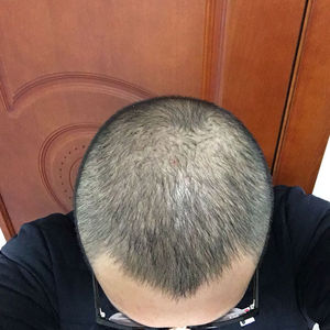 发际线分享社区