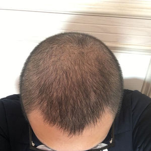 发际线分享社区